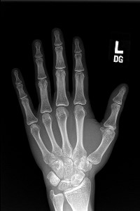 The Bit of Human Left